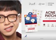 Acne Patch Jadi Trend Baru Gen Z: Lucu, Fungsional, dan Bikin Percaya Diri!